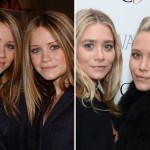 Ashley and Mary-Kate Olsen before and after plastic surgery