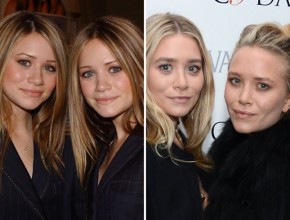 Ashley and Mary-Kate Olsen before and after plastic surgery
