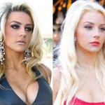 Courtney Stodden before and afterbotox injections 04