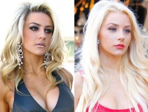 Courtney Stodden before and afterbotox injections 04