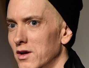 Eminem plastic surgery
