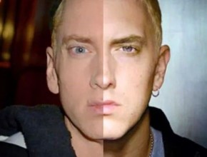 Eminem before and after plastic surgery 01