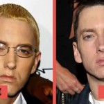 Eminem before and after plastic surgery 04