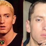 Eminem before and after plastic surgery 05