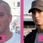Eminem before and after plastic surgery 06