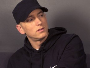 Eminem plastic surgery 06