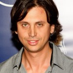 Jonathan Cheban plastic surgery 01