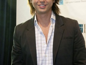 Jonathan Cheban plastic surgery 02