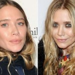 Mary-Kate Olsen before and after plastic surgery 03