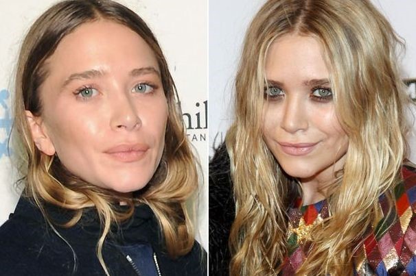 Mary-Kate Olsen before and after plastic surgery 03.