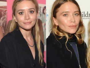 Mary-Kate Olsen before and after plastic surgery