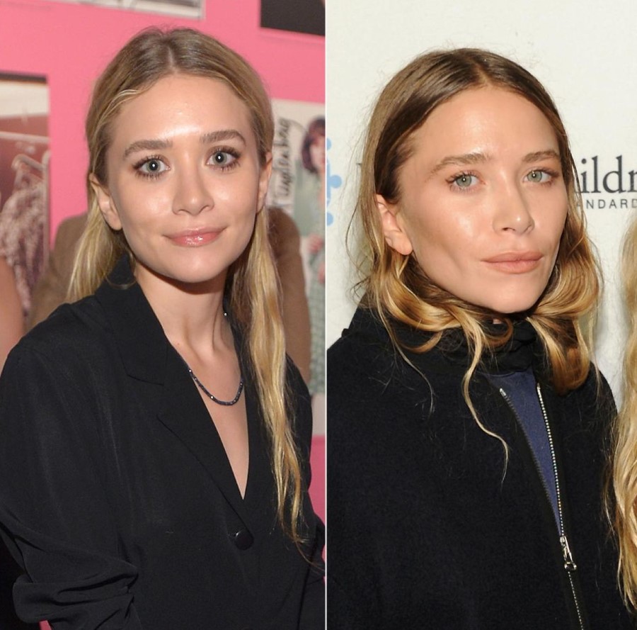 Mary-Kate Olsen before and after plastic surgery