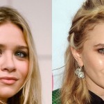 Mary-Kate Olsen before and after plastic surgery 05