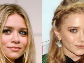 Mary-Kate Olsen before and after plastic surgery 05