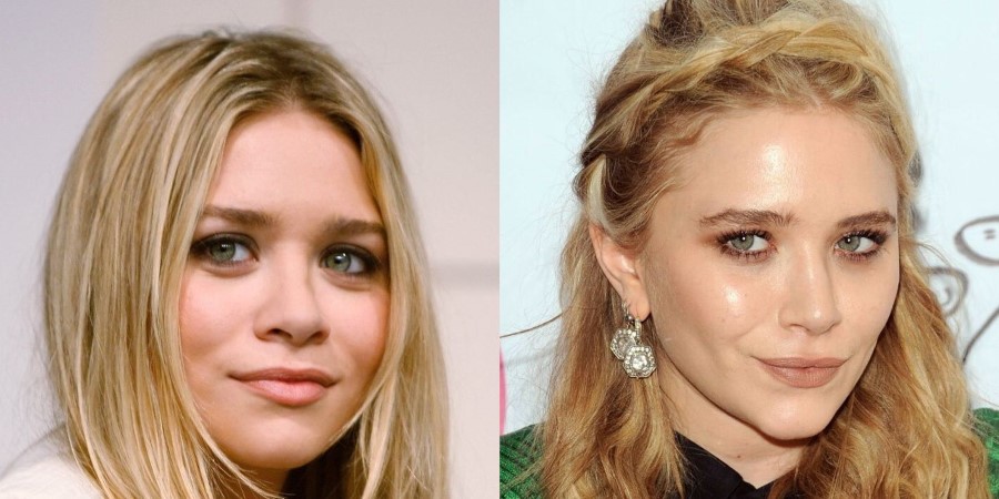 Mary-Kate Olsen before and after plastic surgery 05.