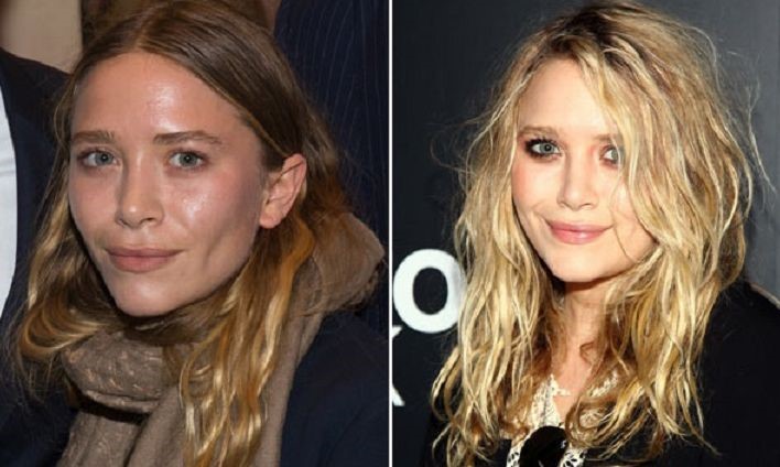 Mary-Kate Olsen before and after plastic surgery.