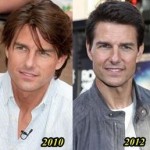 Tom Cruise Plastic Surgery - younger day by day
