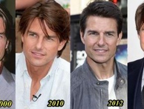 Tom Cruise Plastic Surgery - younger day by day