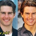 Tom Cruise before and after nose job