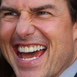 Tom Cruise dental work