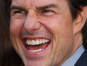 Tom Cruise dental work
