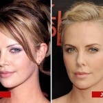 Charlize Theron before and after plastic surgery