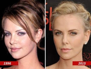 Charlize Theron before and after plastic surgery