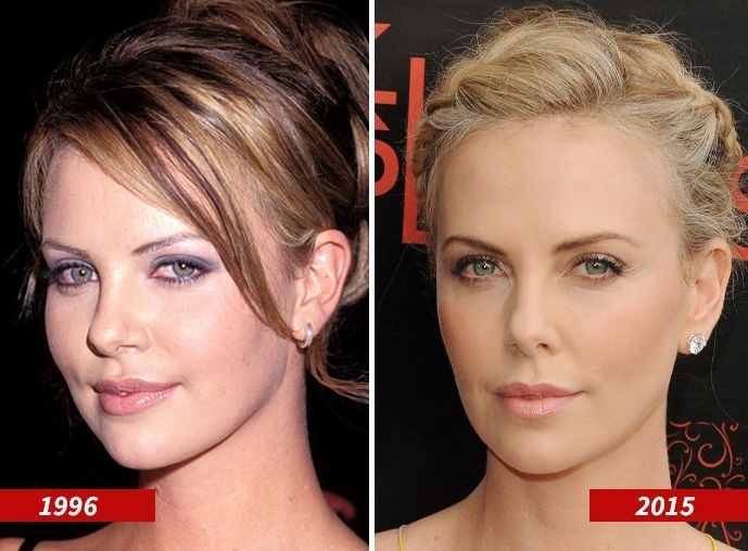 Charlize Theron before and after plastic surgery