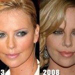 Charlize Theron before and after plastic surgery (2)