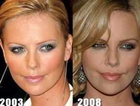 Charlize Theron before and after plastic surgery (2)