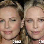 Charlize Theron before and after plastic surgery (32)