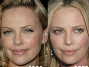Charlize Theron before and after plastic surgery (32)