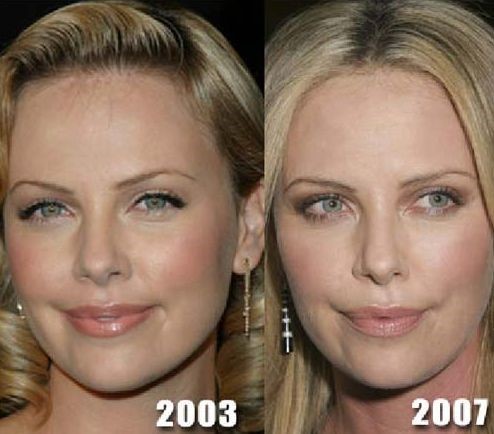 Charlize Theron before and after plastic surgery (32) – Celebrity ...