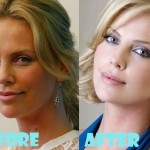 Charlize Theron before and after plastic surgery (4)