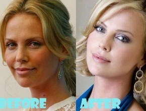 Charlize Theron before and after plastic surgery (4)