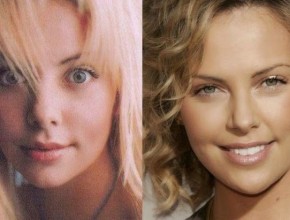 Charlize Theron before and after plastic surgery (5)