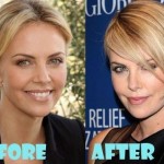 Charlize Theron before and after plastic surgery (6)