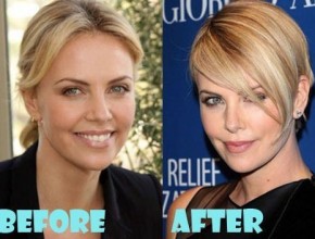 Charlize Theron before and after plastic surgery (6)