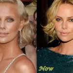 Charlize Theron before and after plastic surgery (8)