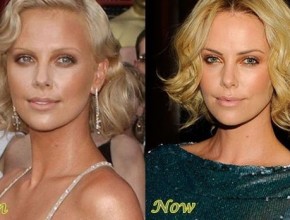 Charlize Theron before and after plastic surgery (8)