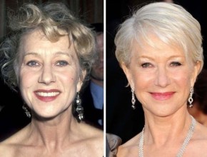 Helen Mirren before and after plastic surgery