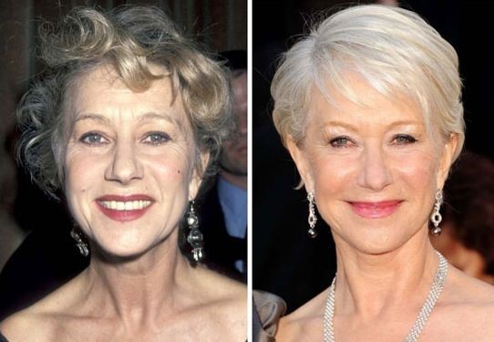 Helen Mirren before and after plastic surgery