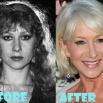 Helen Mirren before and after plastic surgery 03