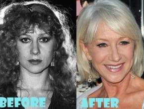 Helen Mirren before and after plastic surgery 03