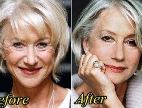 Helen Mirren before and after plastic surgery 04