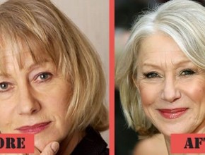 Helen Mirren before and after plastic surgery 05