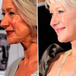 Helen Mirren before and after plastic surgery 06