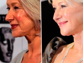 Helen Mirren before and after plastic surgery 06