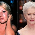 Helen Mirren before and after plastic surgery