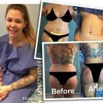 Kailyn Lowry plastic surgery 04